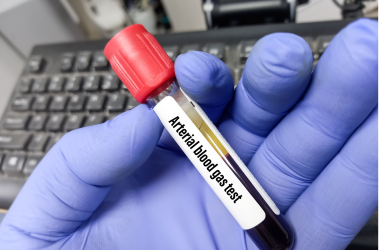Arterial Blood Gas Test