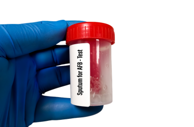 Sputum Test